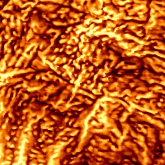 Atomic force microscope scan of diseased skin, showing a rougher and more broken nanotexture than healthy skin.